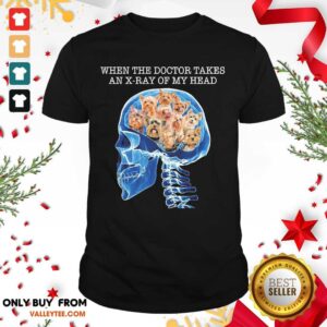 Lovely When The Doctor Takes An X Ray Of My Head Shirt